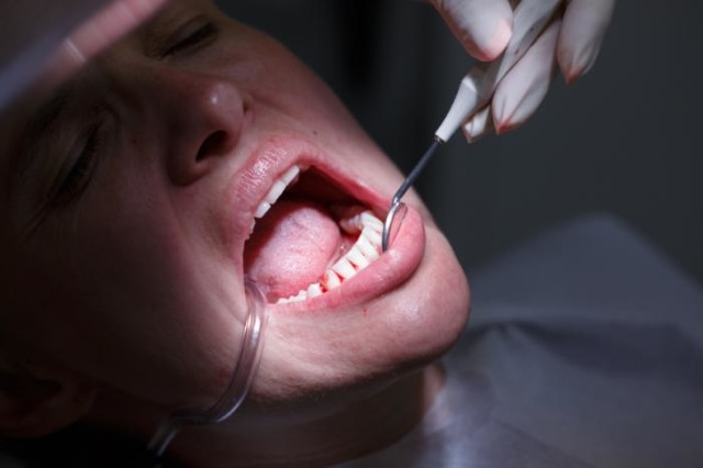 Woman with periodontal disease