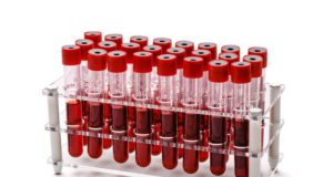 https://www.freepik.com/premium-photo/rack-vacuum-venipuncture-test-tubes-filled-with-blood-samples-isolated-white_11641930.htm#page=2&query=blood+vials&position=42