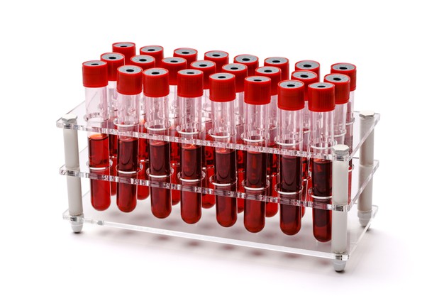https://www.freepik.com/premium-photo/rack-vacuum-venipuncture-test-tubes-filled-with-blood-samples-isolated-white_11641930.htm#page=2&query=blood+vials&position=42