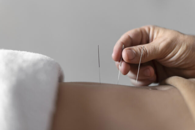 https://www.freepik.com/free-photo/close-up-hand-holding-acupuncture-needle_12066694.htm#query=acupuncture&position=0&from_view=search