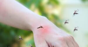 https://www.freepik.com/premium-photo/mosquitoes-bite-adult-hand-made-skin-rash-allergy-with-red-spot_19871029.htm#query=mosquito%20itch&position=4&from_view=search