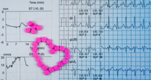 https://www.vecteezy.com/photo/7774195-ekg-or-ecg-electrocardiogram-graph-report-paper-est-exercise-stress-test-result-and-pink-heart-shape-made-from-warfarin-tablet-pills-warfarin-pink-tablets-for-treatment-atrial-fibrillation