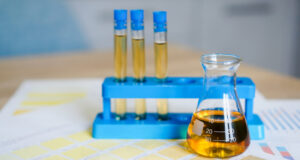 https://www.vecteezy.com/photo/3279946-flask-and-test-tubes-with-urine-on-medical-color-schemes