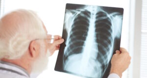 https://www.freepik.com/free-photo/checking-x-ray_5535822.htm#query=lung%20cancer&position=7&from_view=search&track=sph