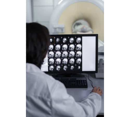 https://www.freepik.com/free-photo/doctor-looking-ct-scan_25053973.htm#query=brain%20study&position=27&from_view=search&track=ais