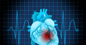 https://www.freepik.com/free-vector/human-heart-disease-symbol_27185341.htm#query=heart%20failure&position=40&from_view=search&track=ais
